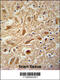 Actin Related Protein 2/3 Complex Subunit 1A antibody, 62-297, ProSci, Immunohistochemistry paraffin image 