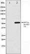Melanocyte Inducing Transcription Factor antibody, orb99119, Biorbyt, Western Blot image 