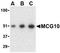 Poly(RC) Binding Protein 4 antibody, TA306079, Origene, Western Blot image 