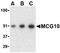 Poly(RC) Binding Protein 4 antibody, TA306079, Origene, Western Blot image 