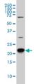 RAB8A, Member RAS Oncogene Family antibody, H00004218-M02, Novus Biologicals, Western Blot image 