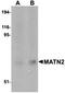 Matrilin 2 antibody, orb75171, Biorbyt, Western Blot image 