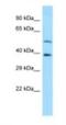 Cyclase Associated Actin Cytoskeleton Regulatory Protein 2 antibody, NBP1-98541, Novus Biologicals, Western Blot image 