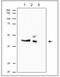 Ribonucleotide Reductase Regulatory Subunit M2 antibody, GTX00888, GeneTex, Immunoprecipitation image 