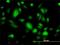 G Protein Subunit Beta 3 antibody, H00002784-M01, Novus Biologicals, Immunocytochemistry image 
