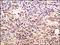 GLI Family Zinc Finger 1 antibody, 251574, Abbiotec, Immunohistochemistry paraffin image 