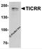 TOPBP1 Interacting Checkpoint And Replication Regulator antibody, 7857, ProSci, Western Blot image 