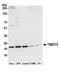 Transmembrane P24 Trafficking Protein 10 antibody, A305-228A, Bethyl Labs, Western Blot image 