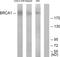 BRCA1 DNA Repair Associated antibody, LS-C118067, Lifespan Biosciences, Western Blot image 