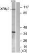 5 -3 exoribonuclease 2 antibody, LS-C119255, Lifespan Biosciences, Western Blot image 