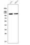 Melanoma Cell Adhesion Molecule antibody, M01683-3, Boster Biological Technology, Western Blot image 