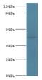 ArfGAP With Dual PH Domains 1 antibody, LS-C375144, Lifespan Biosciences, Western Blot image 