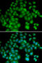 TYB4 antibody, STJ27391, St John