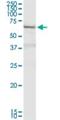 Deltex E3 Ubiquitin Ligase 2 antibody, H00113878-D01P, Novus Biologicals, Western Blot image 