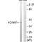 Potassium Two Pore Domain Channel Subfamily K Member 15 antibody, PA5-50090, Invitrogen Antibodies, Western Blot image 