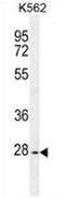 Tyrosine-protein phosphatase non-receptor type 20 antibody, AP53510PU-N, Origene, Western Blot image 