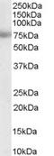 Metastasis Associated 1 antibody, EB05163, Everest Biotech, Western Blot image 