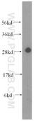 Carbonic Anhydrase 2 antibody, 16961-1-AP, Proteintech Group, Western Blot image 