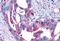 Frizzled Class Receptor 4 antibody, NLS4577, Novus Biologicals, Immunohistochemistry paraffin image 