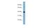 WD Repeat Domain 55 antibody, A13797, Boster Biological Technology, Western Blot image 