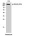Histone Deacetylase 6 antibody, A00595S22, Boster Biological Technology, Western Blot image 