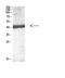 Interleukin 12B antibody, STJ98797, St John