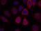 Ribosomal Protein S6 antibody, GTX50552, GeneTex, Immunofluorescence image 
