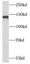 Kinesin Family Member 1C antibody, FNab04556, FineTest, Western Blot image 