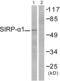 Signal Regulatory Protein Alpha antibody, abx013193, Abbexa, Western Blot image 