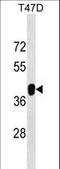 Zinc finger protein 322A antibody, LS-C157439, Lifespan Biosciences, Western Blot image 