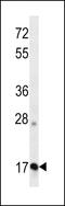 Apolipoprotein O antibody, LS-C156430, Lifespan Biosciences, Western Blot image 