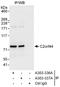 WD Repeat And Coiled Coil Containing antibody, A303-336A, Bethyl Labs, Immunoprecipitation image 