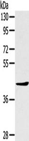 TNFAIP3 Interacting Protein 2 antibody, TA351830, Origene, Western Blot image 