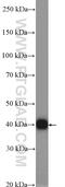 Protein Kinase AMP-Activated Non-Catalytic Subunit Beta 1 antibody, 10308-1-AP, Proteintech Group, Western Blot image 