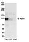 Aspartate Beta-Hydroxylase antibody, A305-342A, Bethyl Labs, Western Blot image 
