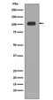 Lysine Demethylase 1A antibody, M00532-1, Boster Biological Technology, Western Blot image 