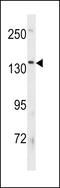 ATPase Phospholipid Transporting 8B3 antibody, 60-925, ProSci, Western Blot image 