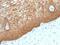 Keratin 14 antibody, NBP2-48042, Novus Biologicals, Immunohistochemistry paraffin image 