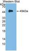 Dystroglycan 1 antibody, LS-C725554, Lifespan Biosciences, Western Blot image 