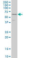 Dihydropyrimidinase Like 3 antibody, LS-C133161, Lifespan Biosciences, Western Blot image 