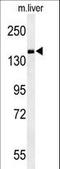 Phosphodiesterase 6C antibody, LS-C163472, Lifespan Biosciences, Western Blot image 