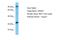 Olfactory Receptor Family 4 Subfamily A Member 47 antibody, A16522, Boster Biological Technology, Western Blot image 