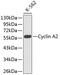 Cyclin A2 antibody, 13-011, ProSci, Western Blot image 