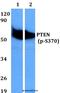 Phosphatase And Tensin Homolog antibody, A00006S370-1, Boster Biological Technology, Western Blot image 