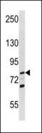 RecQ Like Helicase antibody, LS-C203833, Lifespan Biosciences, Western Blot image 
