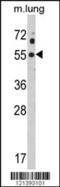 Potassium Voltage-Gated Channel Subfamily J Member 2 antibody, 62-541, ProSci, Western Blot image 