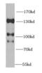 Histone Deacetylase 4 antibody, FNab03800, FineTest, Western Blot image 