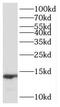 Sterol Carrier Protein 2 antibody, FNab07653, FineTest, Western Blot image 