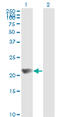 NME/NM23 Nucleoside Diphosphate Kinase 1 antibody, LS-B6104, Lifespan Biosciences, Western Blot image 