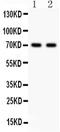 Sex Hormone Binding Globulin antibody, PA5-79994, Invitrogen Antibodies, Western Blot image 